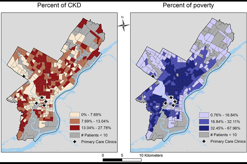 Chronic Kidney Disease by neighborhood in Philadelphia